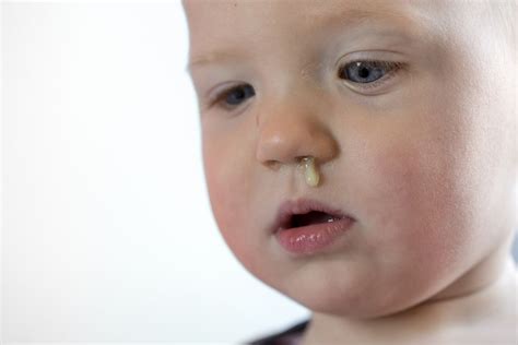 Why do little kids have so much snot?