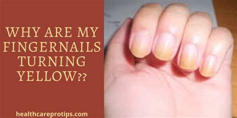 Why do matte nails turn yellow?