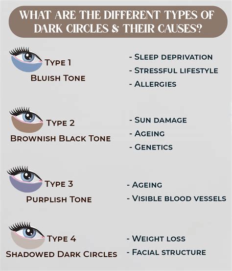 Why do most girls have dark circles?