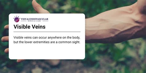 Why do people want visible veins?