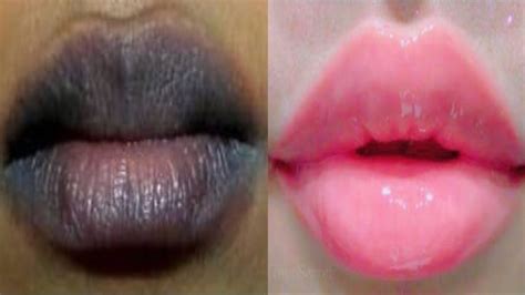 Why do pink lips turn black?