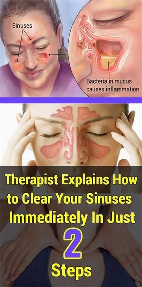Why do sinuses take so long to clear?