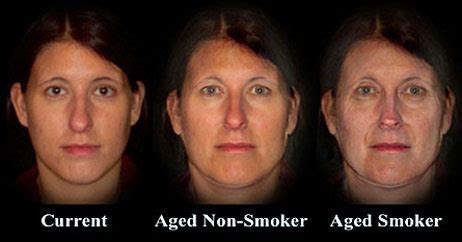 Why do smokers have puffy eyes?