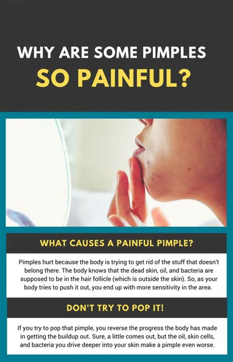 Why do some pimples hurt so bad?