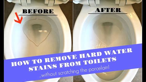 Why do some toilets stain easier than others?