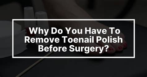 Why do they ask about nail polish before surgery?