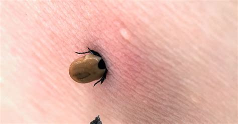 Why do ticks prefer certain humans?