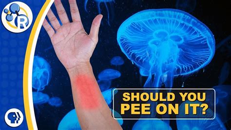 Why do you pee on jellyfish?