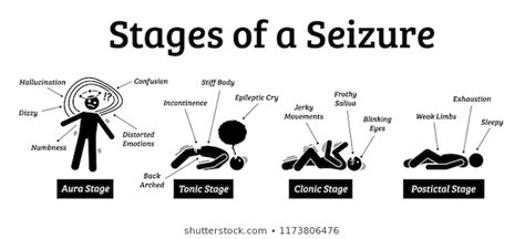 Why do you scream before a seizure?