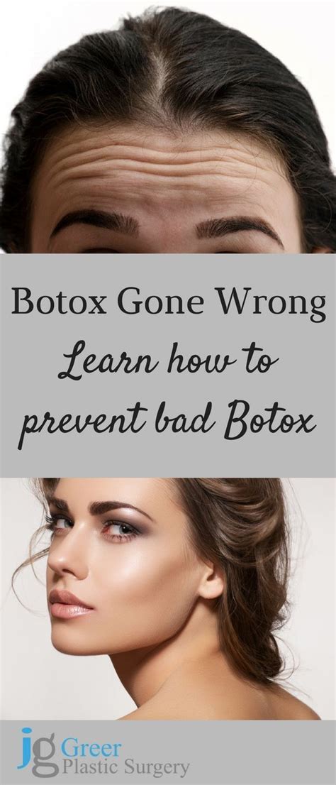 Why does Botox look bad on some people?