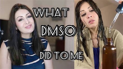 Why does DMSO smell so bad?