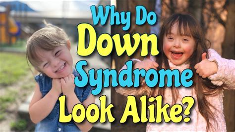 Why does Down syndrome make your face weird?