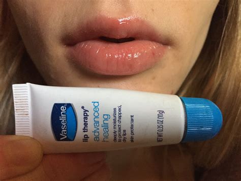 Why does Vaseline make my lips break out?