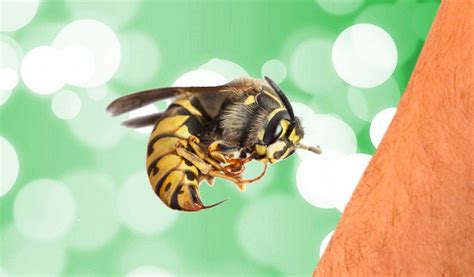 Why does a bee sting hurt so much?