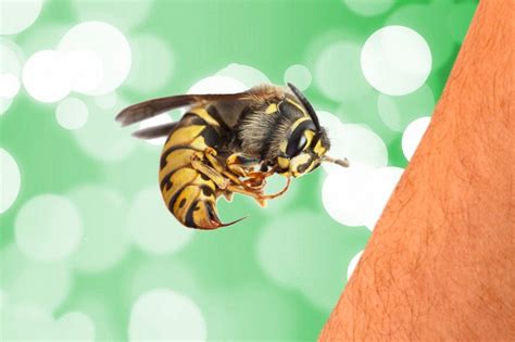 Why does bee venom hurt so much?