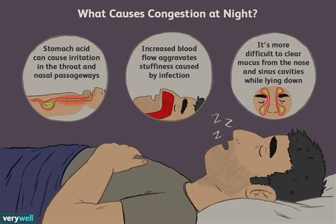 Why does congestion get worse at night?