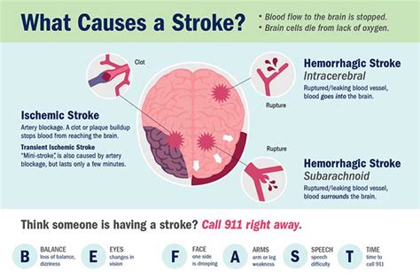 Why does high sodium cause stroke?