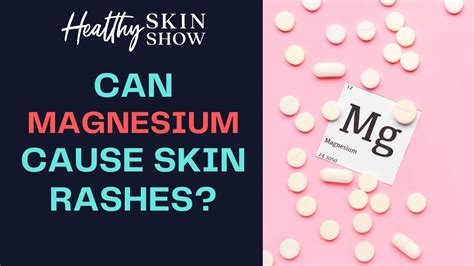 Why does magnesium burn?