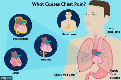 Why does my chest hurt after a hot shower?