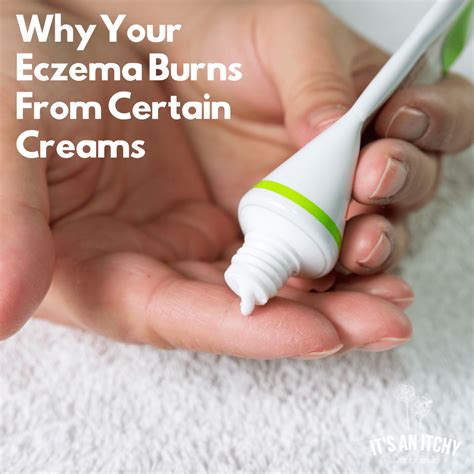 Why does my eczema burn when I put cream on it?