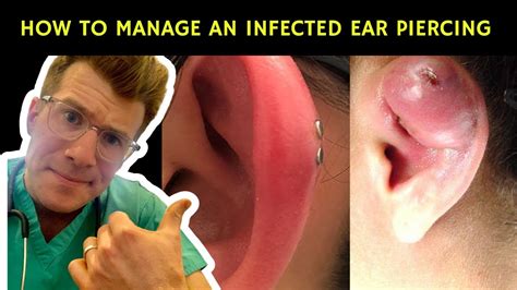 Why does my healed ear piercing have pus?