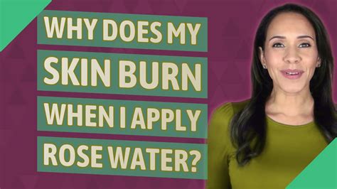 Why does my skin burn after applying rose water?