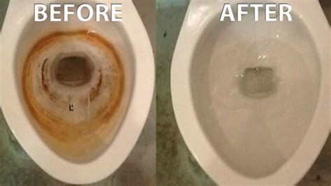 Why does my toilet bowl stain so easily?