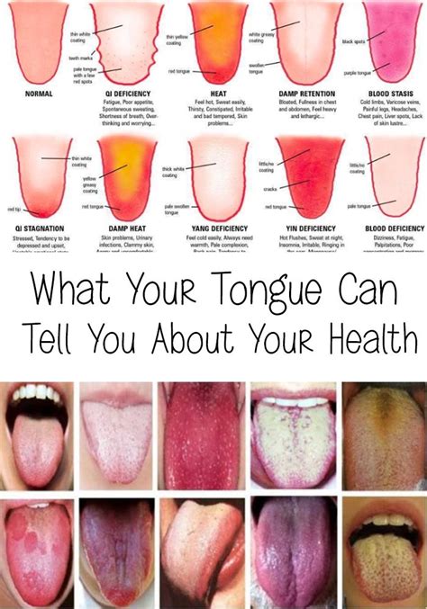 Why does my tongue no longer fit in my mouth?