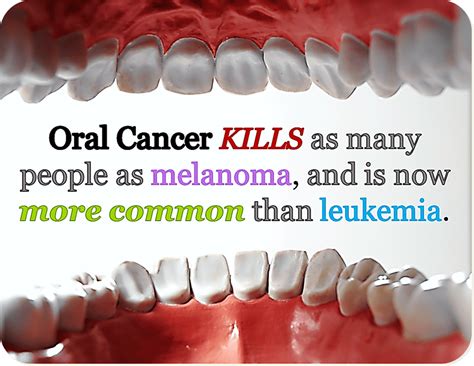 Why does oral cancer have such a high death rate?