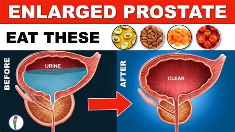 Why does pressing the prostate feel good?