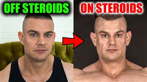 Why does testosterone change face shape?