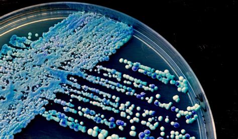 Why does yeast need O2?