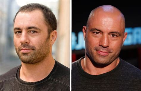 Why don't celebrities go bald?