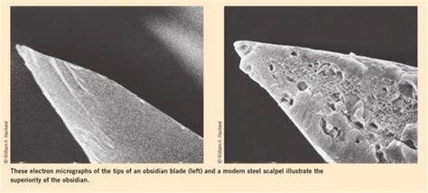 Why don t surgeons use obsidian?