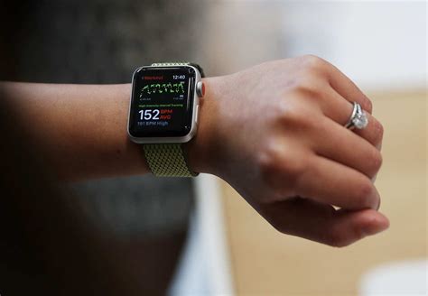 Why is Apple Watch a medical device?