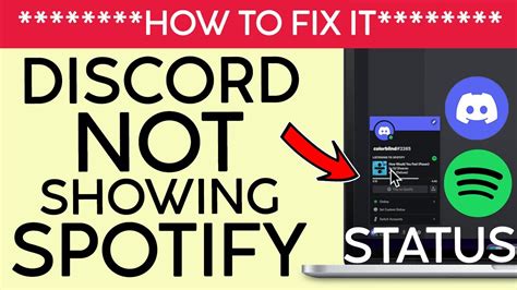 Why is Discord not showing my Spotify?