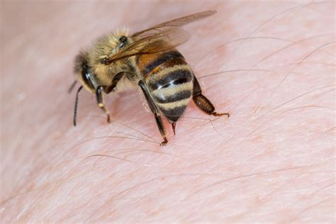 Why is bee sting hot?