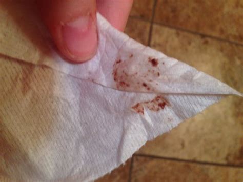 Why is dried blood sticky?