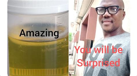 Why is early morning urine the best sample to be tested?