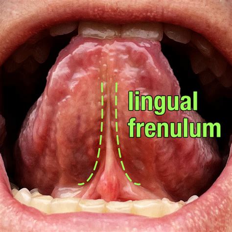 Why is frenulum short?