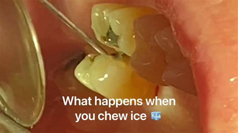 Why is it fun to chew ice?
