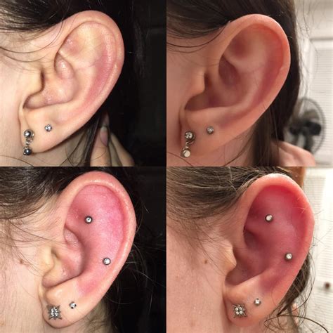 Why is my helix piercing swollen after a year?