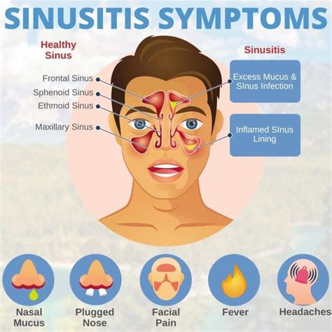 Why is my mouth infection not responding to antibiotics?