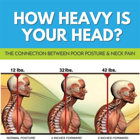 Why is my neck posture so bad?