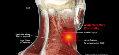 Why is my neck so sensitive to touch?