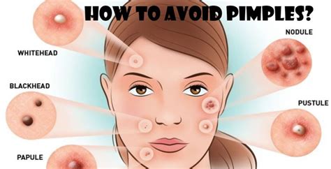 Why is my pimple not shrinking?