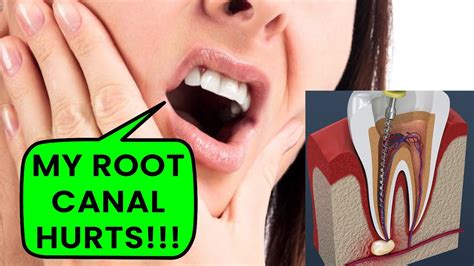 Why is my root canal tooth hurting after months?