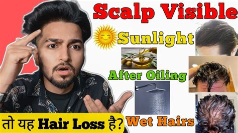Why is my scalp visible after oiling?