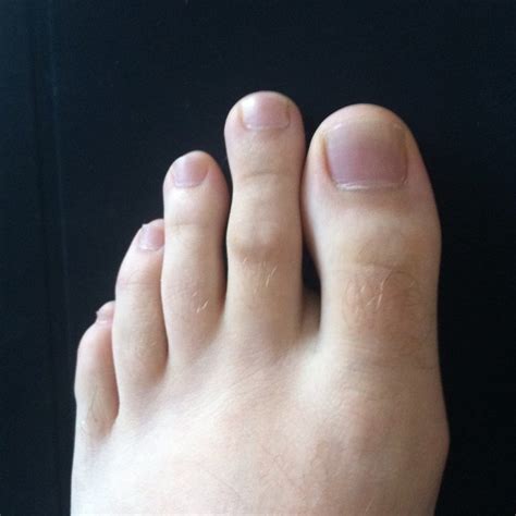Why is my second toe bigger than the rest?