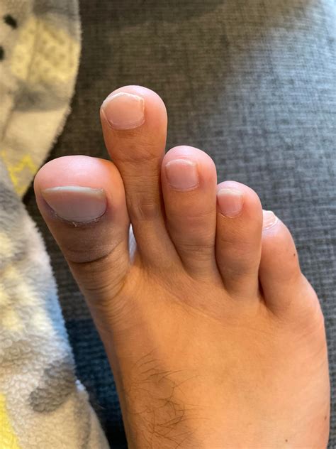 Why is my second toe shorter than the rest?